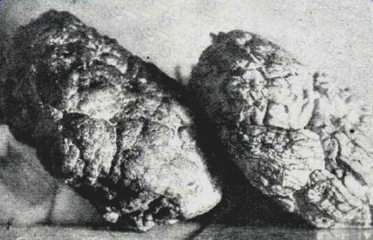 Кремниевый артефакт (слева) и настоящий человеческий мозг (справа)
